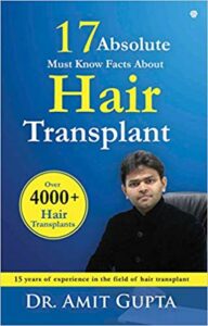 Facts about hair transplant